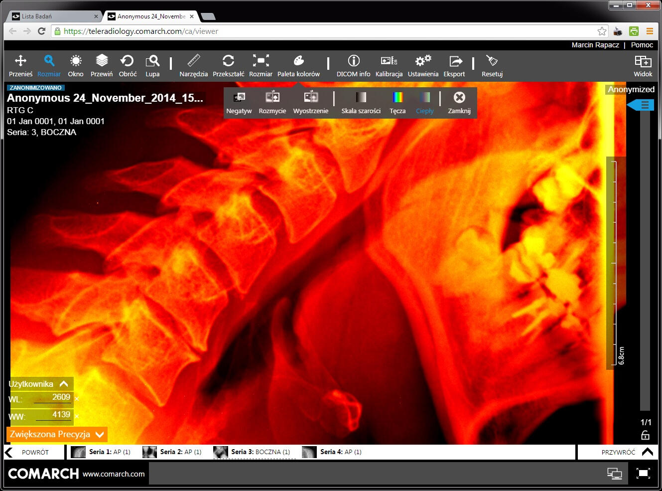 Web-based Teleradiology Solution project screenshot